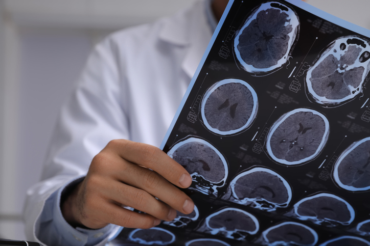 traumatic brain injury scans